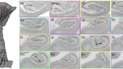 Curved Multiplanar Reformatting Allows the Accurate Histological Delineation of Hippocampal Subfields. featured image